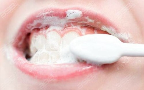 牙齿发黄怎么去除变白-美白牙膏