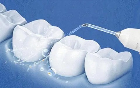 一分钟教会你水牙线的正确使用方法，防止牙齿龋坏