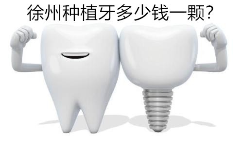 分享徐州各口腔医院种植牙价格，徐州种植牙哪家医院好看这里