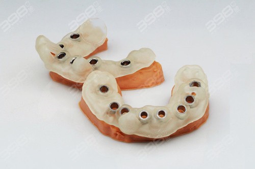导板种植牙与普通种植牙区别是？
