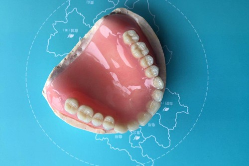吸附性义齿有几种档次？哪些牌子的吸附性义齿比较好？