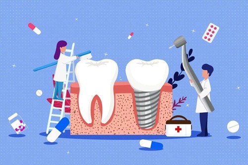 广州种牙齿多少钱一颗？植牙可以享受医保吗？