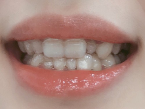 长沙美奥口腔和牙大夫哪个好?牙齿矫正医院哪家更好一些?
