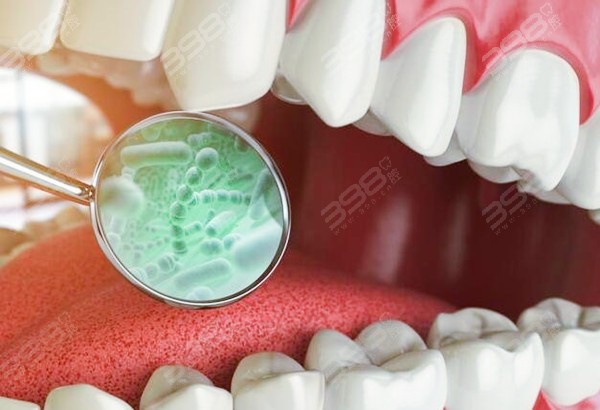 牙缝里的细菌