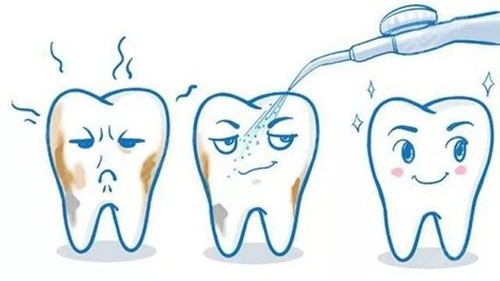洗牙可以去除口臭吗？