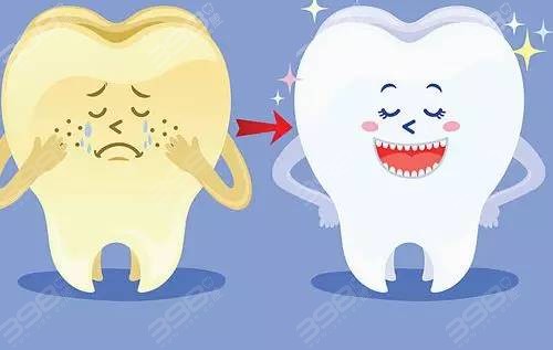 洗牙能把黄牙洗白吗？