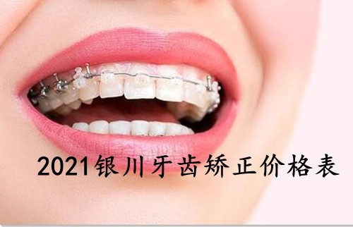 2021银川牙齿矫正价格表公布，都是正规牙科的收费标准