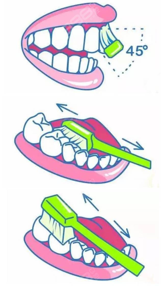 刷牙法