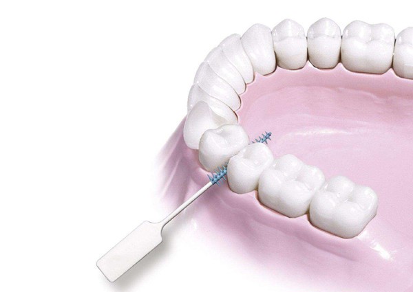 戴牙套期间怎么清洁牙齿，才能在摘牙套时不会脱矿？