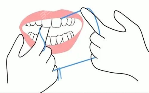 为什么说用牙签对牙齿不好？