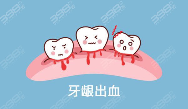 牙龈出血怎么办