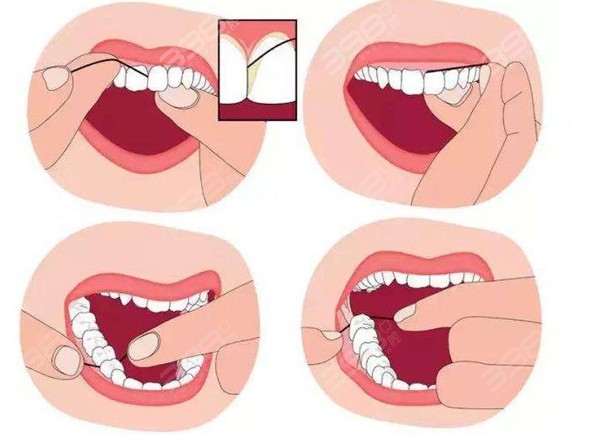 牙线用法