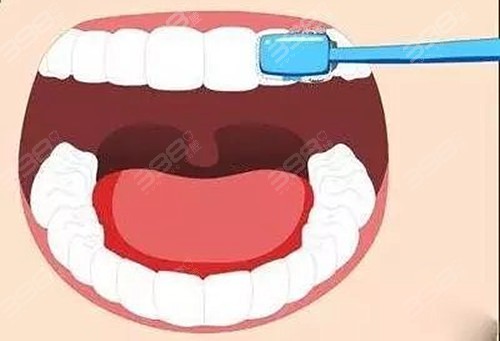 使用冲牙器后还要刷牙吗？
