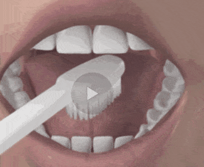 刷牙到底要不要刷舌头