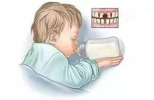 还在喝奶的小孩牙齿为什么变黑