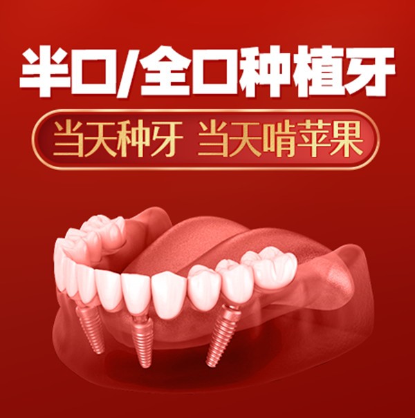 享受北京中诺口腔种植牙价格补贴,我做了all-on-4全口种植