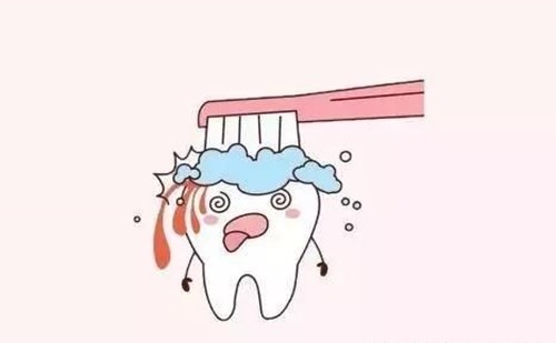 长期不刷牙牙齿会怎么样？这些危害对牙齿的伤害很大