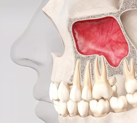 75岁老人牙槽骨萎缩能做种植牙吗？种植医生是这么回答的