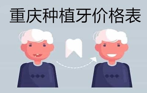 以自己在重庆做全口种植牙的经历，来谈谈重庆全口种植牙多少钱