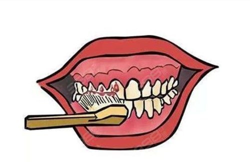 刷牙牙龈经常出血是什么原因