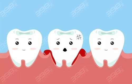 刷牙牙龈经常出血是什么原因