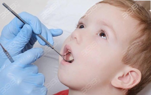 宝宝换牙期间，家长需要做到的“四要”和“四不要”