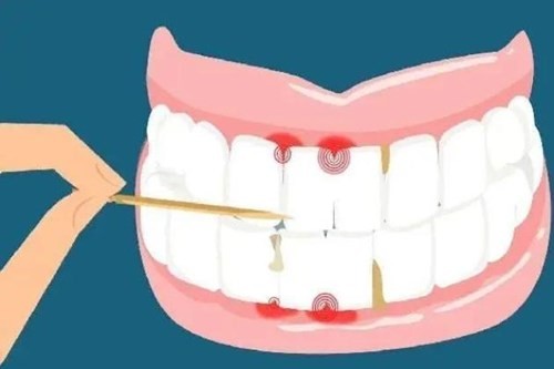 这些伤害牙齿的不良习惯看看你占了几条