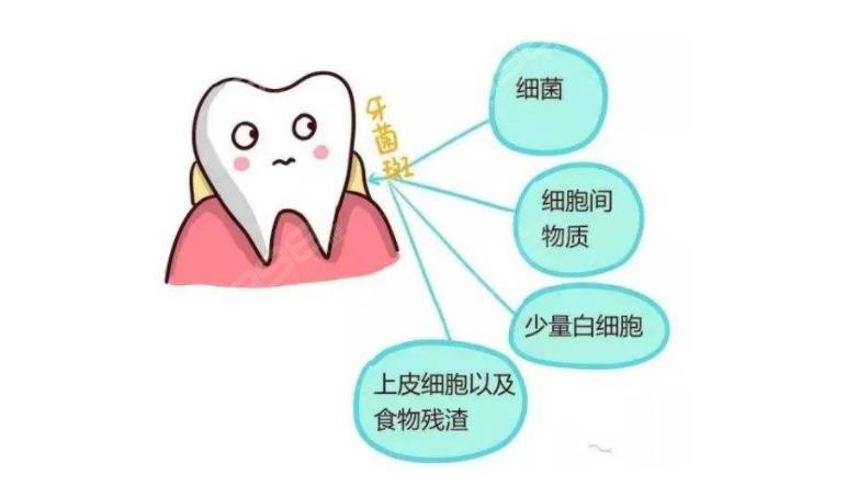 牙菌斑的产生