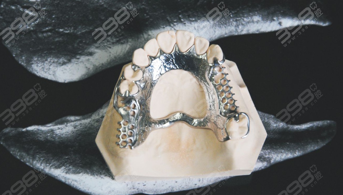 牙齿矫正支架图片