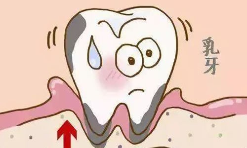 婴儿长牙不按顺序有危害吗？正确的长牙顺序是什么？