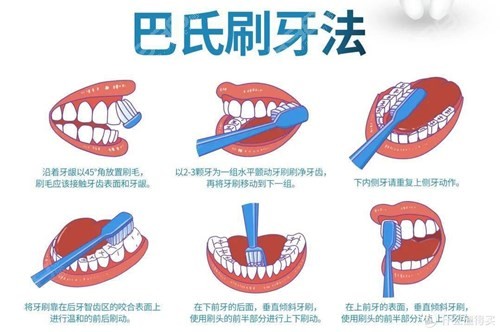 牙齿矫正中怎么才能有效的清洁牙齿