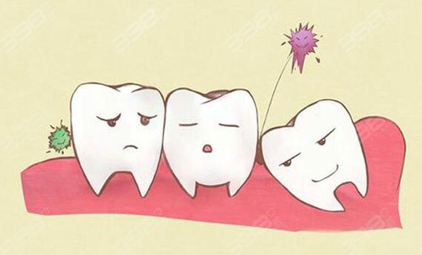 为什么牙医建议拔掉智齿
