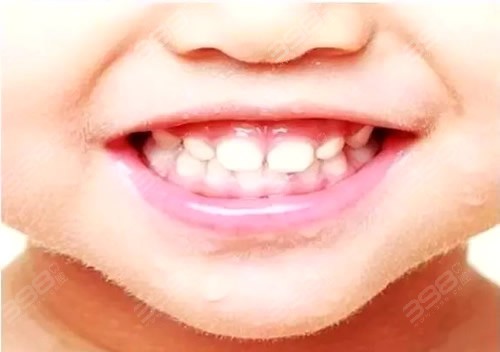 儿童牙齿健康