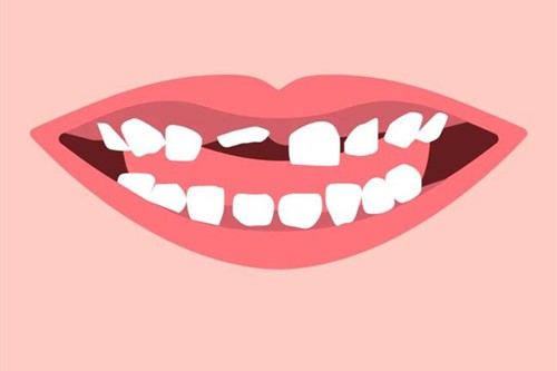 小朋友牙齿不齐是什么原因造成的？这几个习惯千万要避免