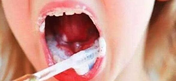 关于刷牙的3个冷知识，帮助你正确做好口腔清洁工作