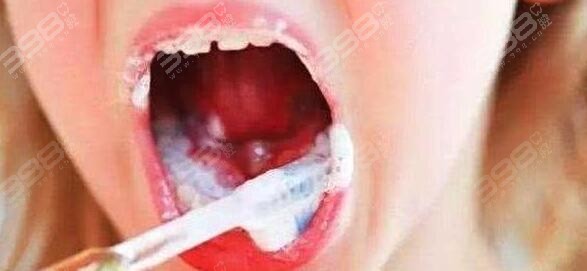 刷牙时，牙膏要不要沾水？