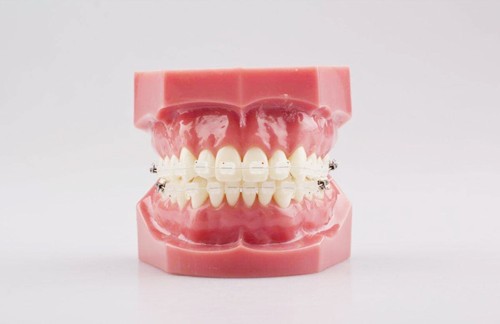 郑州牙齿矫正多少钱？公布郑州牙科医院金属、隐形牙收费标准