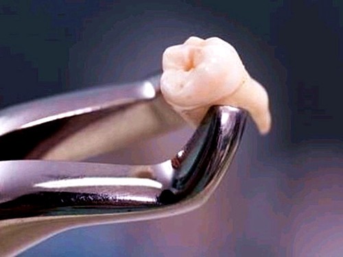 上海拔牙可以用医保卡吗？上海能用医保牙科有哪些？