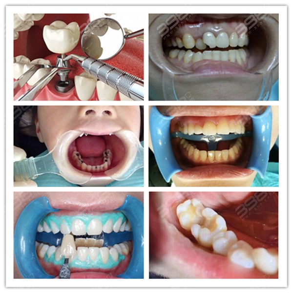 种植牙、牙齿矫正、儿童牙科、牙齿修复、牙齿美白