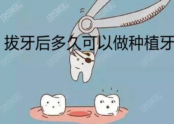 拔完牙多久可以做种植牙？来参考拔牙后种植牙最佳时期