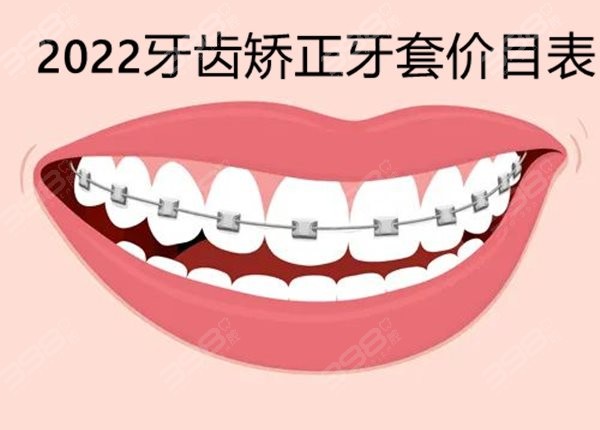 更新2022牙齿矫正牙套价目表，内含隐形、金属、陶瓷半隐形矫正价格