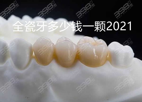 现公布全瓷牙真实成本价格，来看看2021全瓷牙多少钱一颗