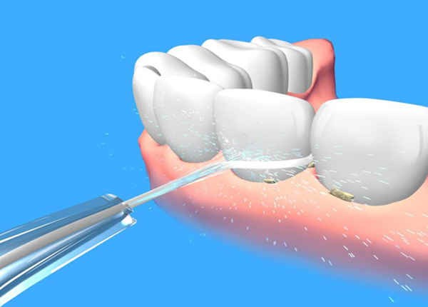怎么使用水牙线呢？分享水牙线的正确操作方法
