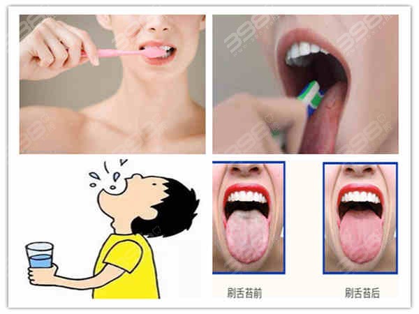 刷牙时要不要刷舌头