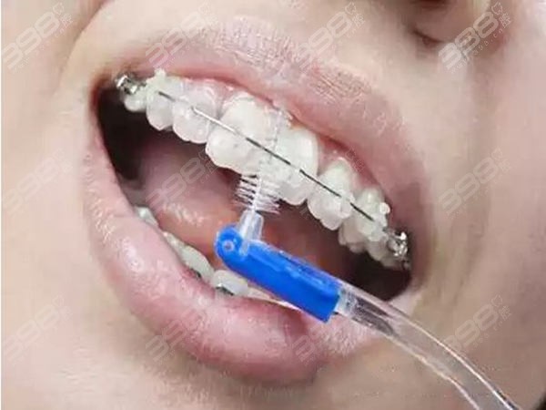 牙线清洁牙齿