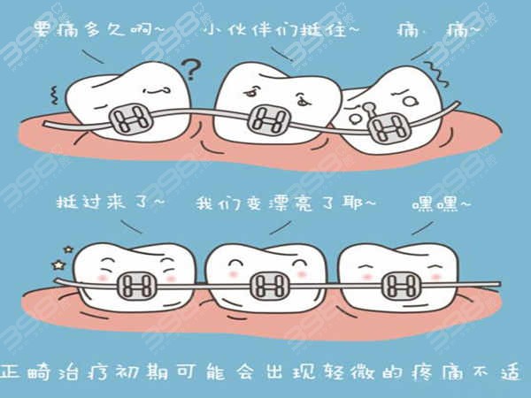 牙齿矫正的第二阶段
