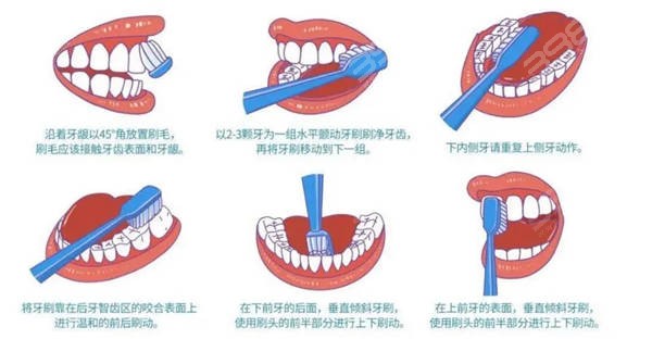 巴氏刷牙
