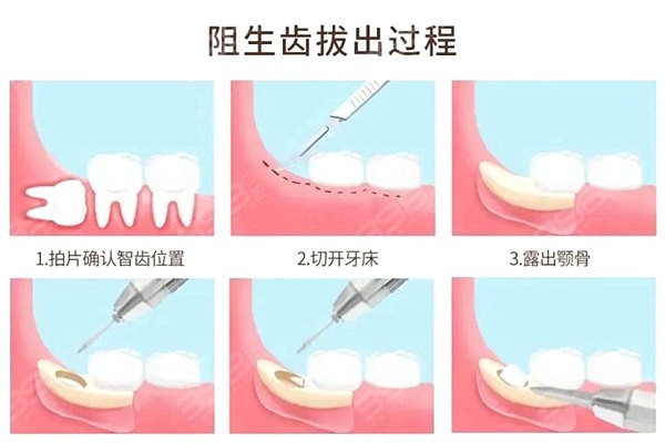 上海静安牙科价格一览表