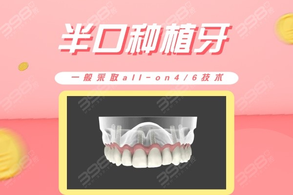惠州半口/全口种植牙收费标准