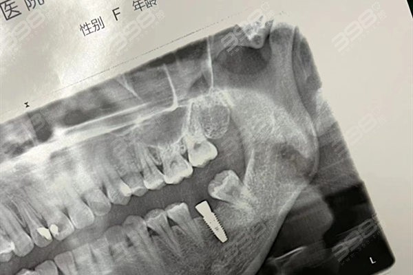 福清医院牙科收费标准